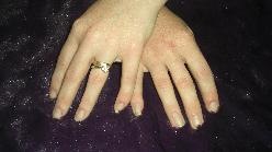 Nails before application of tips and gel